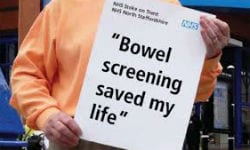 Healthy lifestyle & bowel cancer survival